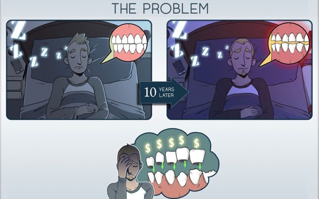 bruxismo